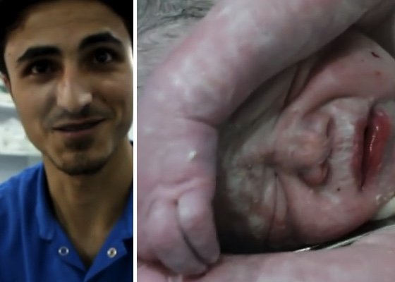 Niebywała akcja ratowania dziecka ciężarnej, rannej w wyniku wybuchu bomby w Syrii (FOTO+VIDEO)